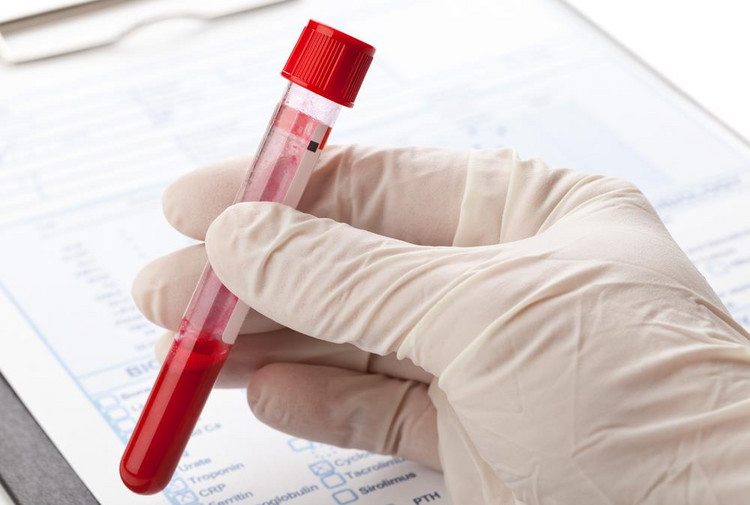 Jakie badania trzeba wykonać, aby wykryć HCV?