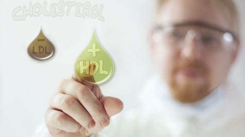 Mi az LDL - HDL? Miért fontos az egyensúlya?