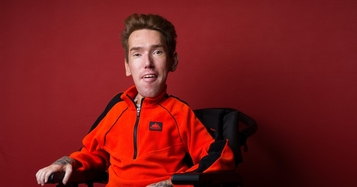 Rozśmiesza ludzi do łez. A później godzinami dochodzi do siebie pod respiratorem