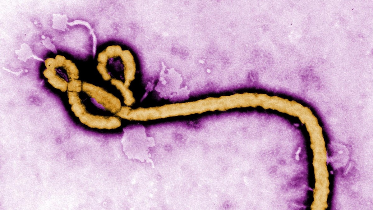 Ebola Virus