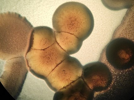 Halálos szuperbaktériumot fedeztek fel, amely orvosi műanyagon lakmározik