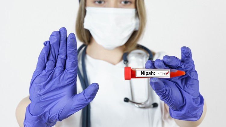 nipah, koronavírus, denevér, Kemenesi Gábor