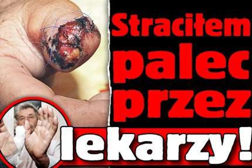 Straciłem palec przez lekarzy!