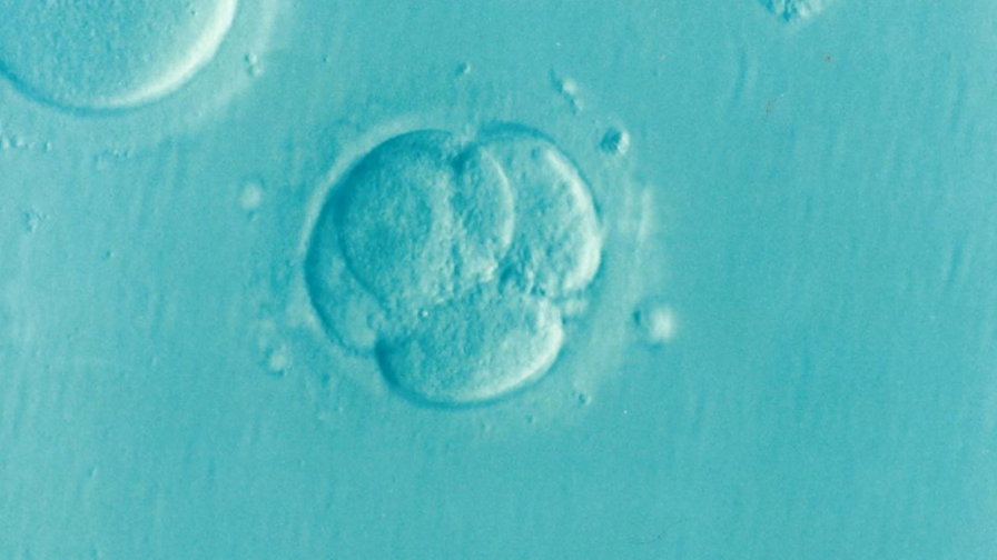 Na zdjęciu ludzki embrion we wczesnej fazie rozwoju, fot. Dr Elena Kontogianni, CC0, via Wikimedia Commons. 