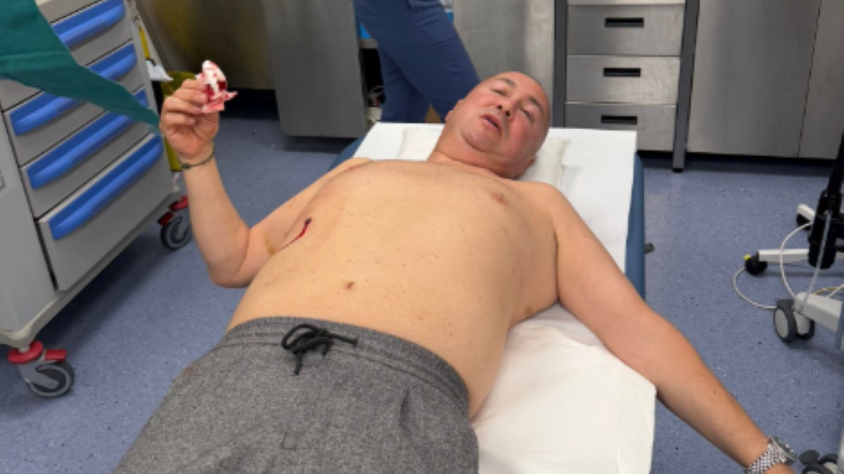 Prva slika Đanija nakon ujeda