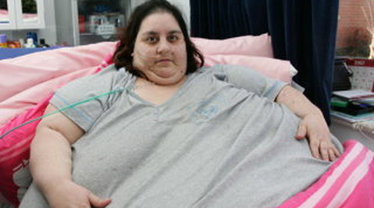 Halálra zabálta magát a 285 kilós nő