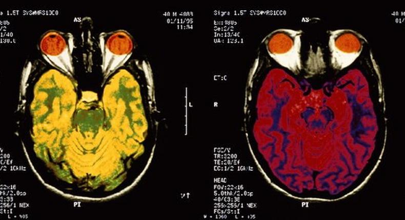 Studies published this year shed light on the mysteries of the brain and human behavior, and began paving the way for new treatments to mental and neurological health problems, ranging from addiction to autism to Alzheimer's disease.