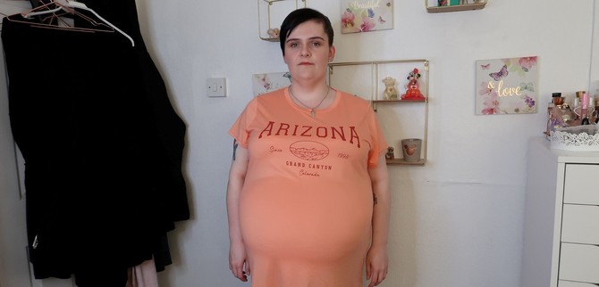 Mislili su da je trudna a onda je otišla na pregled i usledio je šok