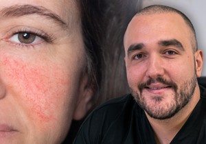 Dr Branislav Lukić, specijalista oftalmologije i sertifikovani lekar estetske medicine