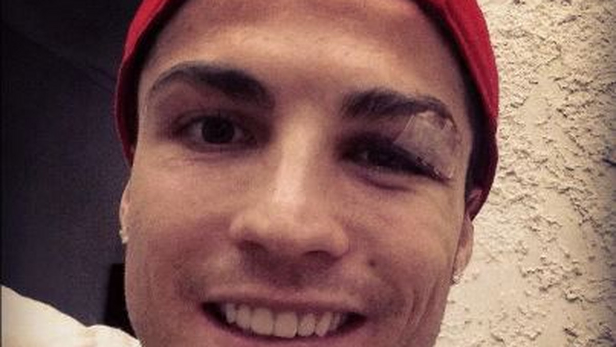 Z przyjemnością informujemy, że Cristiano Ronaldo, zawodnik Realu Madryt, czuje się dobrze. Zawodnik znów się uśmiecha, a z jego lewym okiem jest już coraz lepiej.