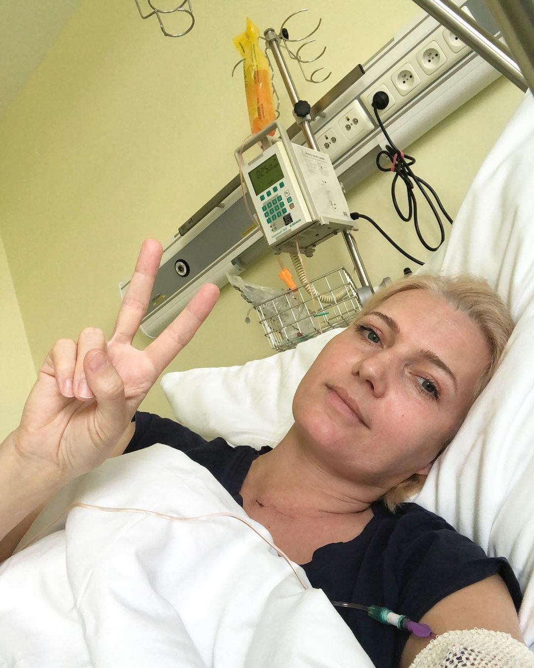 Aneta Parišková bojovala s rakovinou ako levica. 