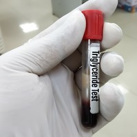 Mit jelent a triglicerid érték a laborleleten?