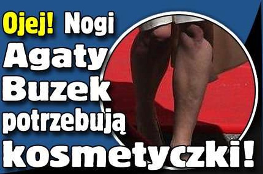 Ojej! Nogi Agaty Buzek potrzebują kosmetyczki!