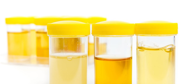 Urynoterapia rzeczywiście działa? Właściwości moczu