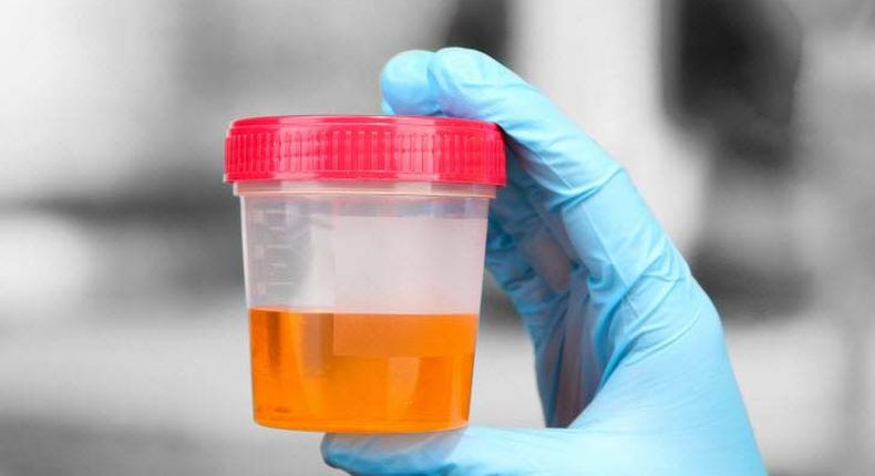 Urine can indicate if you have health issues