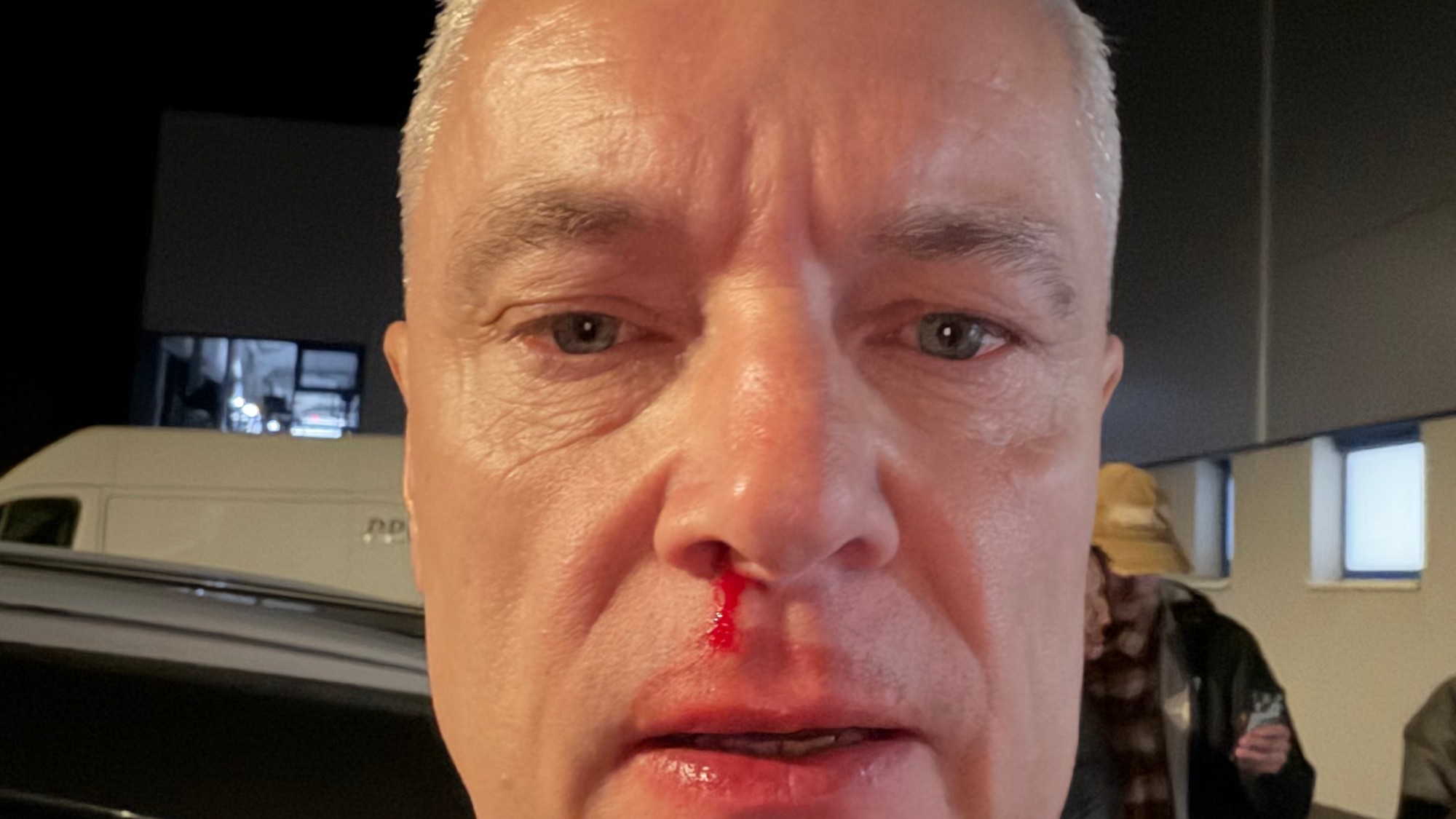 Ján Ferenčák tvrdí, že útok sa stal v sobotu o 22:40, o 22:52 ho nahlásil štátnej polícii a 22:56 urobil túto fotografiu