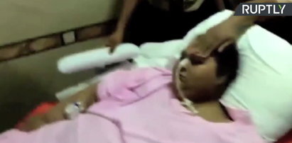 Była najcięższa kobieta świata wypisana ze szpitala w Indiach po udanej operacji
