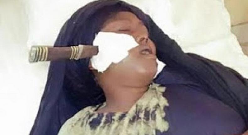 The good news is that the knife in Fatima Ibrahim's face has been removed