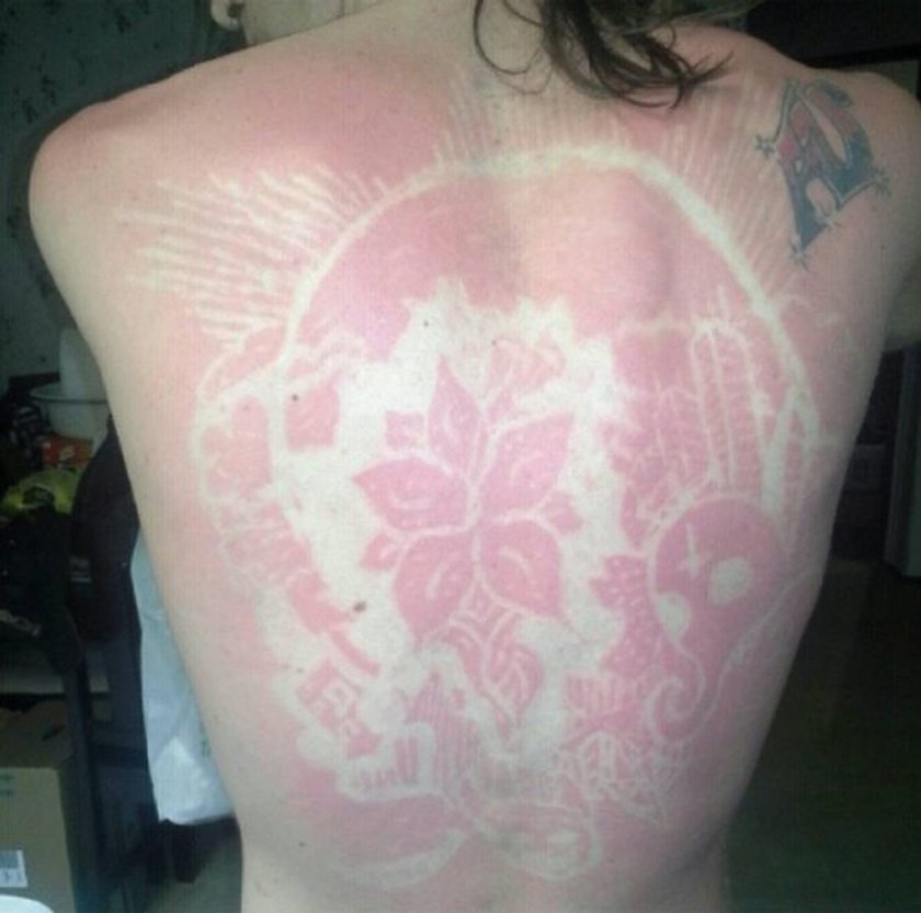 Sunburn Art