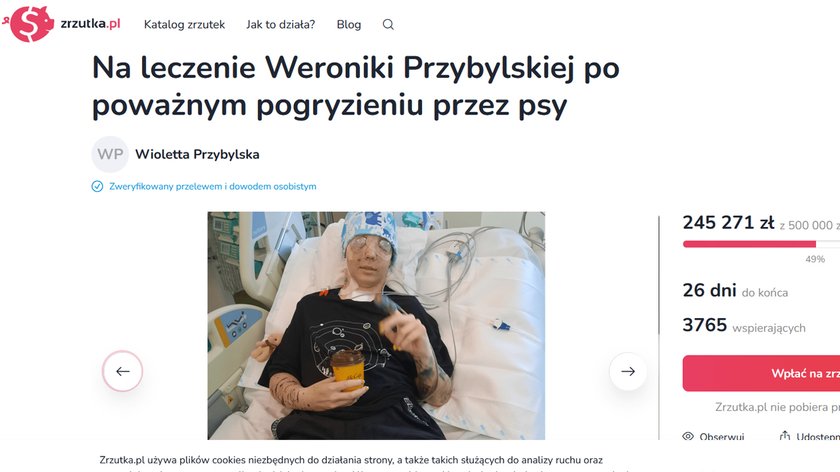 W maju sfora psów pogryzła 18-letnią Weronikę