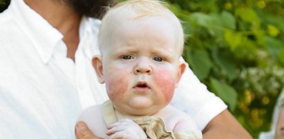 Malec nie był zaszczepiony przeciw COVID-19, więc odmówiono mu przeszczepu. Rodzice też pozostawali nieugięci, tymczasem bez nowego serduszka dziecko było bez szans