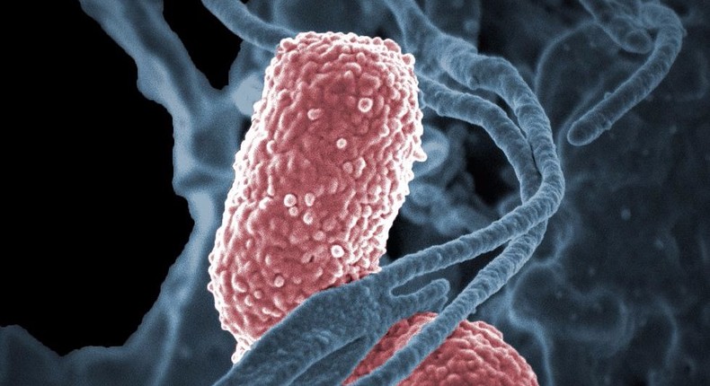 Klebsiella pneumoniae Bacteria