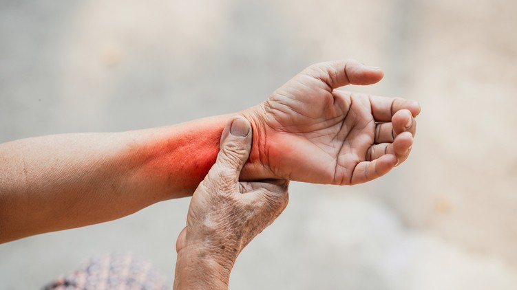 rheumatoid artritisz is okozhat reggeli ízületi merevséget