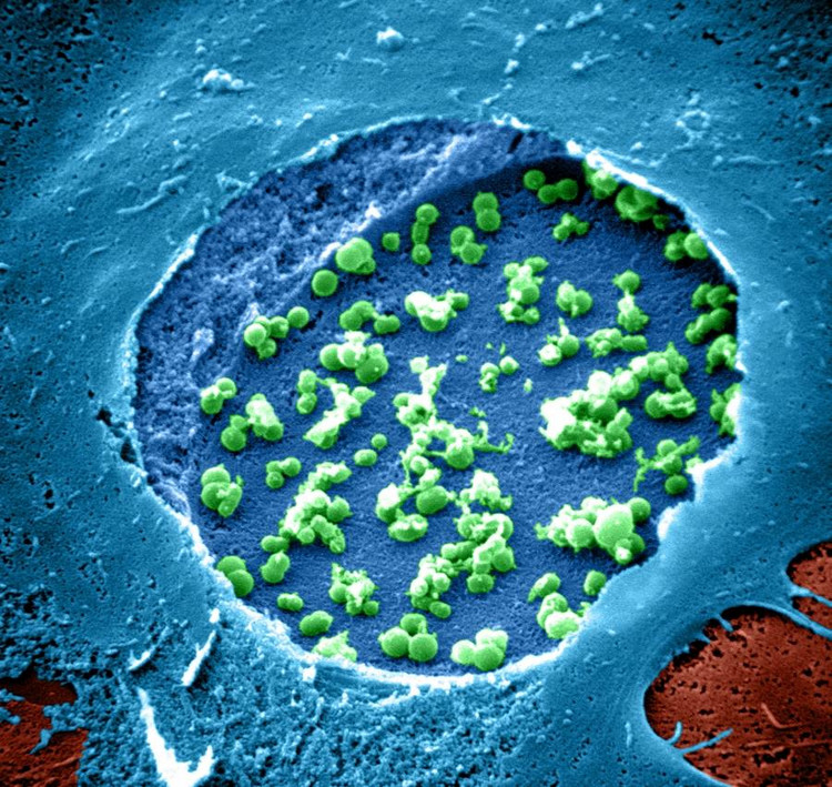 Chlamydia trachomatis