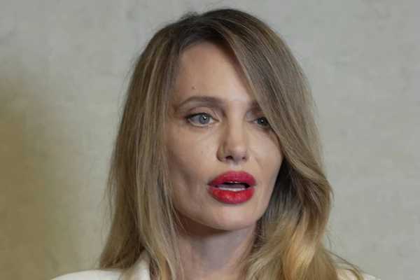 Plastični hirurg detaljno objasnio KAKO JE UPROPAŠĆENO LICE ANĐELINE DŽOLI: Evo šta je zaista dovelo do ovako NESREĆNOG REZULTATA