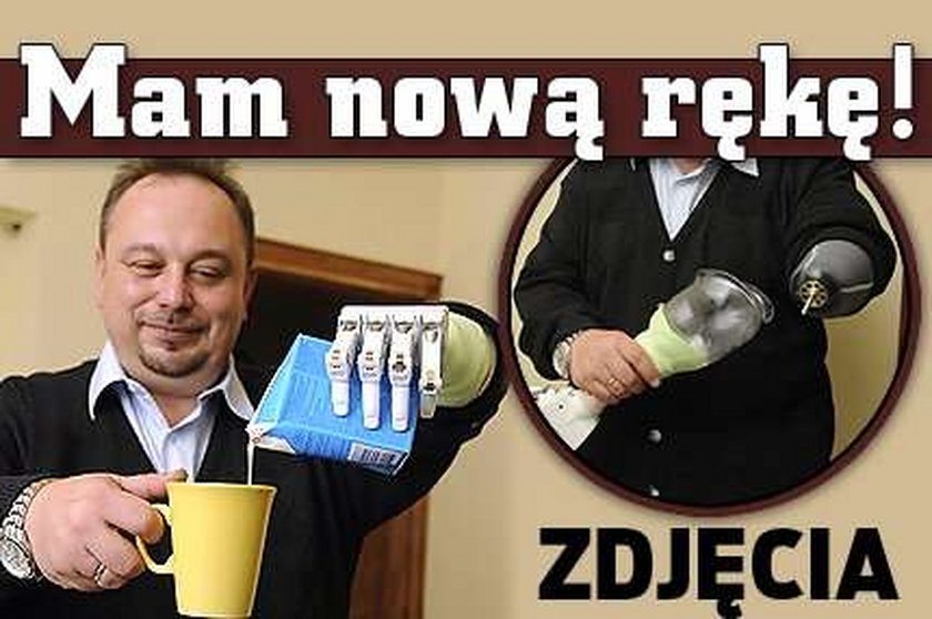 Dostałem nową rękę. ZDJĘCIA