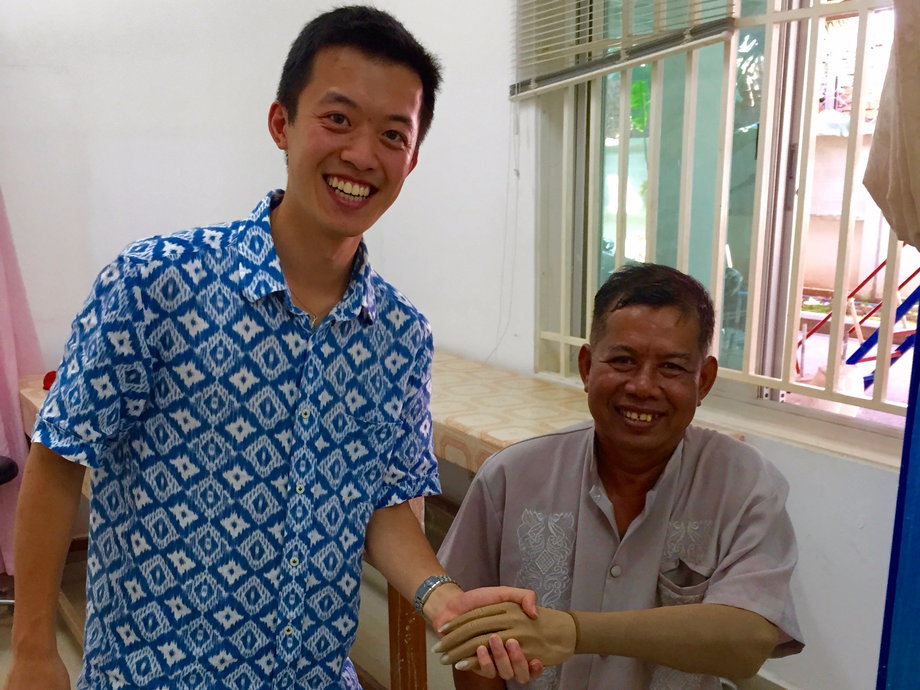 Alex Yang designed a way to 3-D print customized prosthetics for under $5.