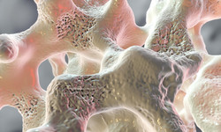 Osteoporoza to cichy zabójca. Jak z nią walczyć?