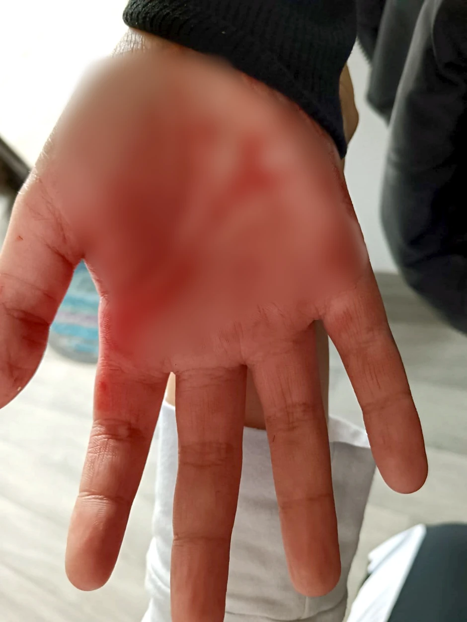 V.S, učenik iz Vlasotinca, vršnjačko nasilje