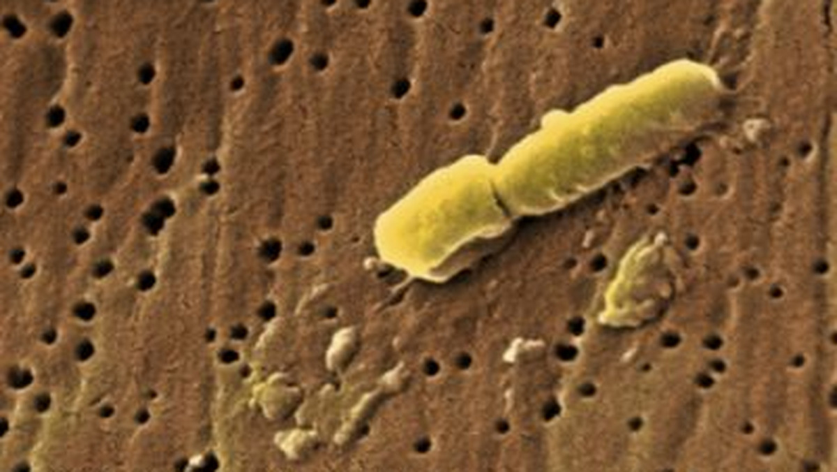Stało się to, czego lekarze obawiali się od dawna. Bakteria oporna na niemal wszystkie antybiotyki doprowadziła do śmierci mieszkańca Belgii. W Wielkiej Brytanii i Australii przybywa pacjentów, którzy po powrocie z Indii zainfekowani są zmutowanymi szczepami zarazków Klebsiella pneumoniae i Escherichia coli.