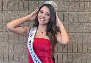 Misica umrla posle 10 godina borbe sa opakom bolešću: Takmičila se i dok je bila na hemioterapiji