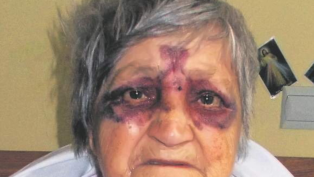 91-letnia pacjentka połczyńskiego szpitala spadła z łóżka i dotkliwie się potłukła. NFZ uznał, że lecznica musi za to zapłacić - poinformował "Głos Koszaliński".