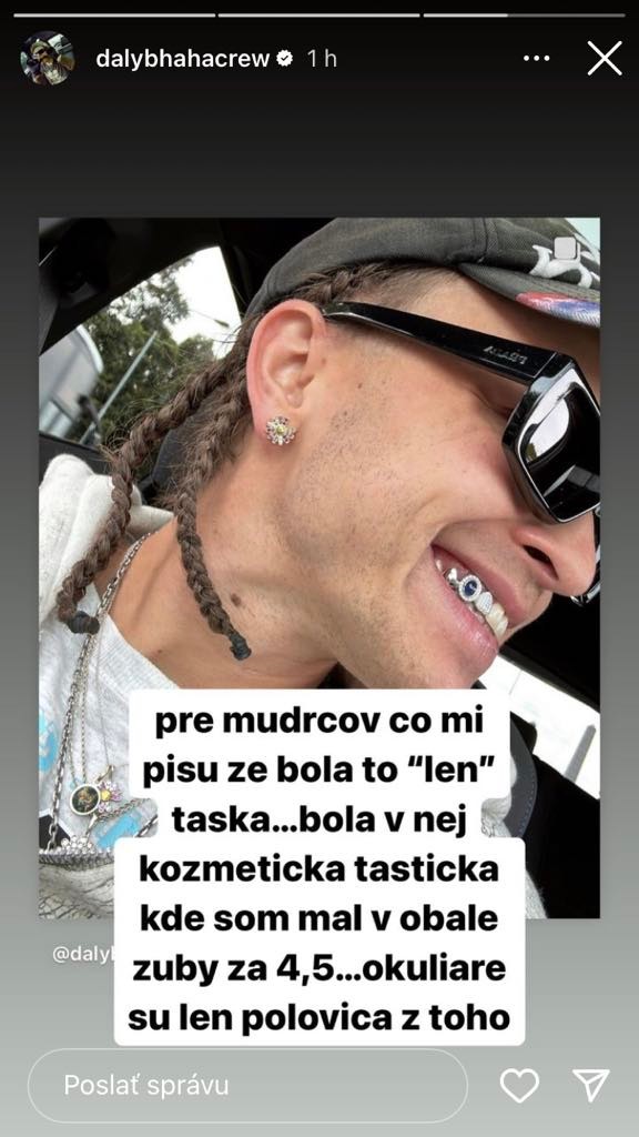 Raper Dalyb prišiel o cennú kúsky.