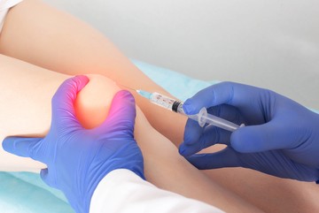 Kinek javasolt a porcújjáépítő, ízületi injekció?