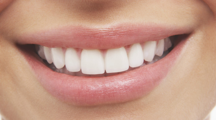 Lehet, hogy egészséges, de a fogainknak nem tesz jót a vegán életmód /Illusztráció: Northfoto