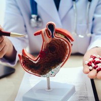 Sok a sava, refluxbeteg? Nem mindegy milyen fájdalomcsillapítót vesz be, ha fáj valamije
