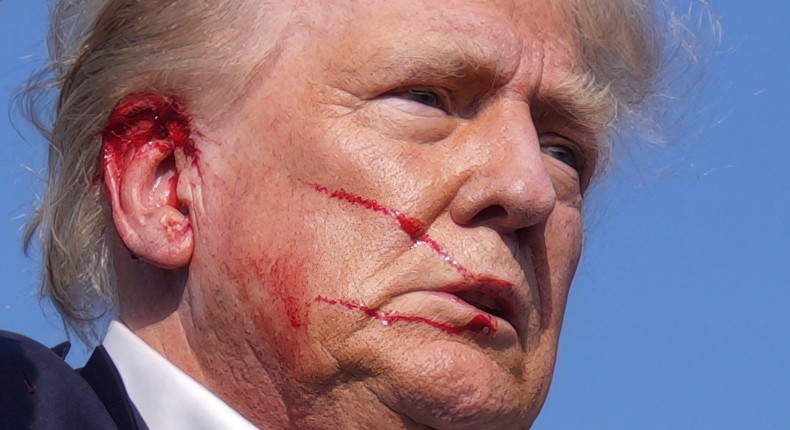 Former President Donald Trump was escorted off-stage with blood on his face after an assassination attempt in Pennsylvania.Evan Vucci