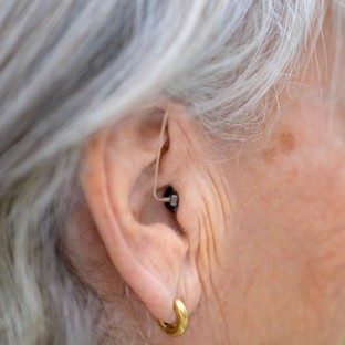 Az ilyen fülbe épített mikrofonok segíthetnek „meghallgatni” az Alzheimer-kór korai jeleit