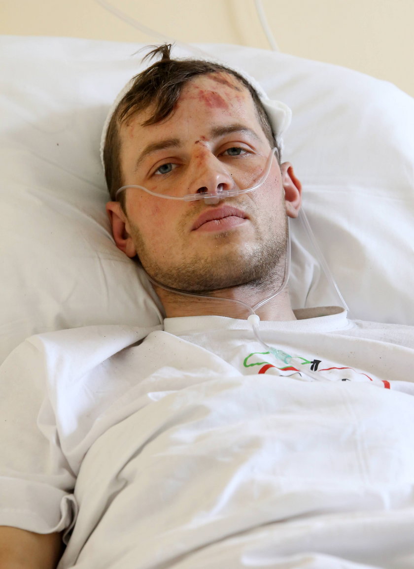 Tusk wstrzymał leczenie rannych z Majdanu