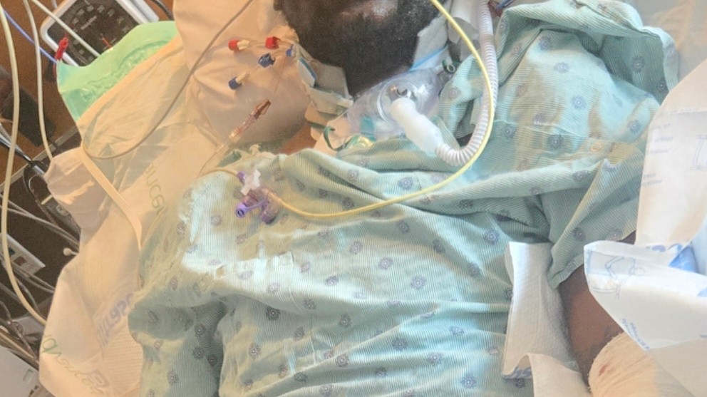 Preventívna prehliadka u zubára sa pre Davona skončila amputáciou končatín.