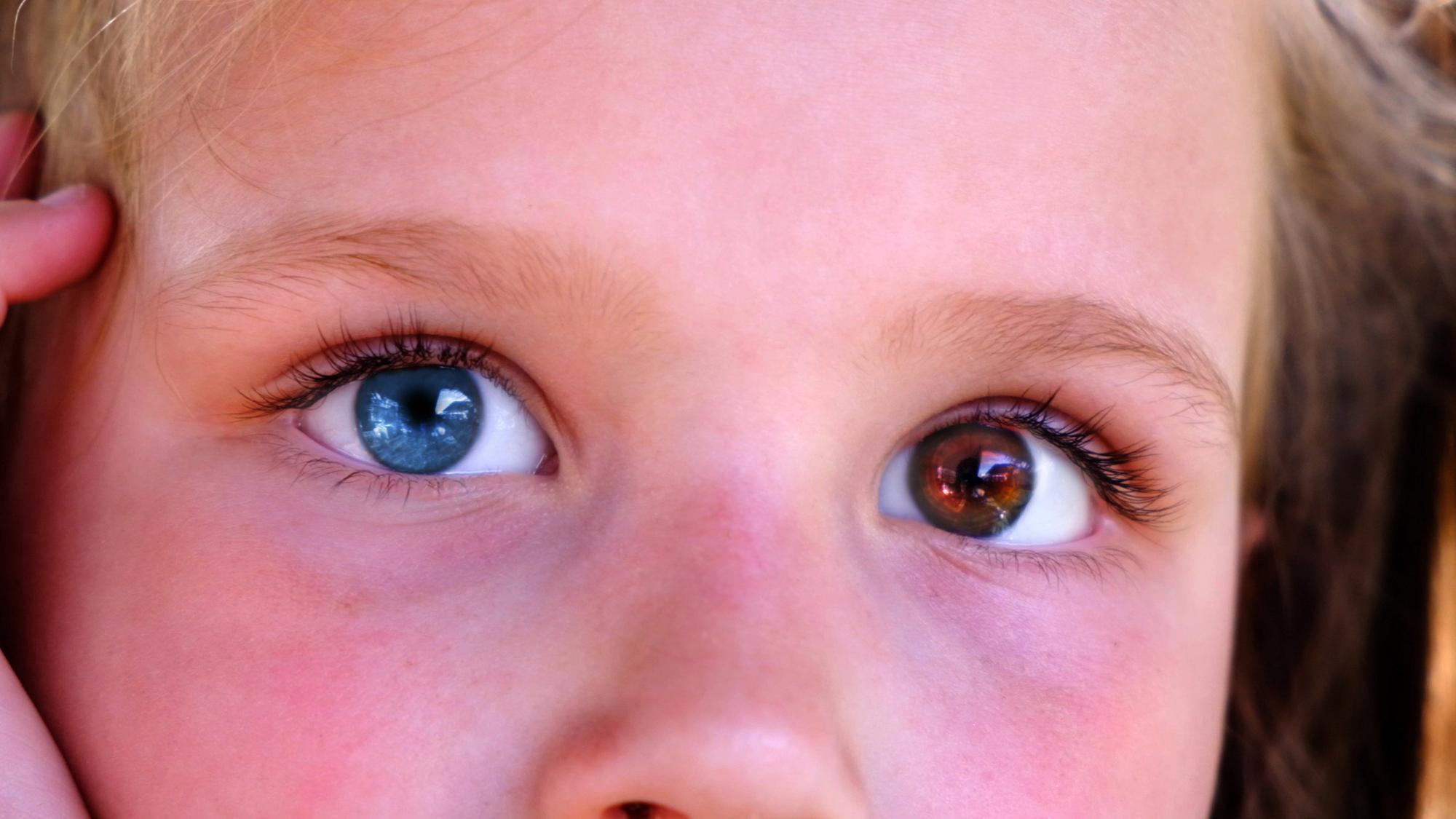 Na sociálnych sieťach sa rozšírila nová metóda zmeny farby očí.