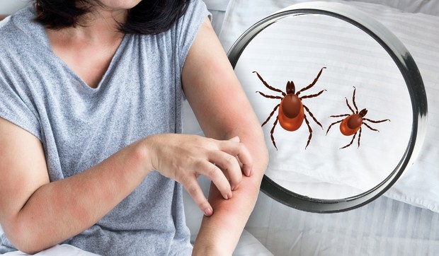 Za razliku od buva, stenice isključivo ujedaju ljude dok spavaju