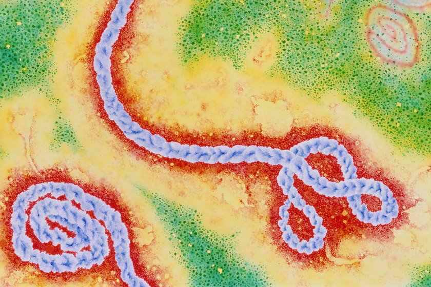 Wirus Eboli