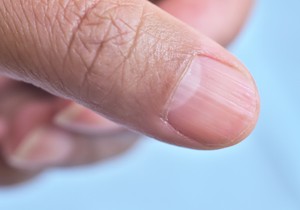 Polumesec na noktima