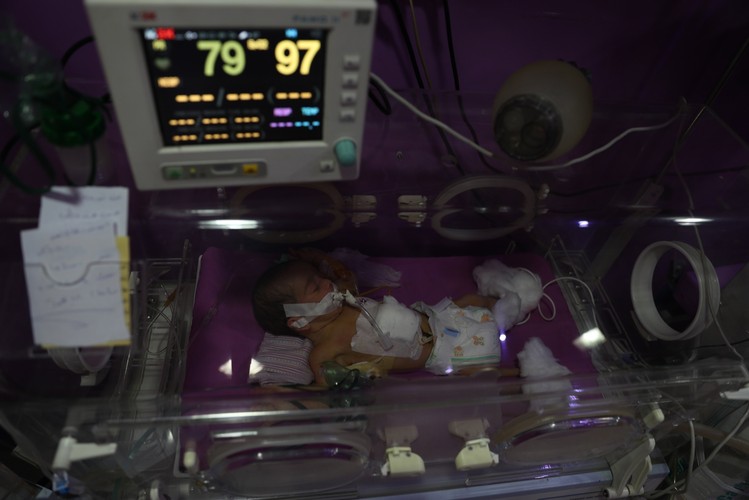 LEKARZE-BOHATEROWIE. OPEROWALI NOWORODKA, KONSULTUJĄC SIĘ PRZEZ INTERNET