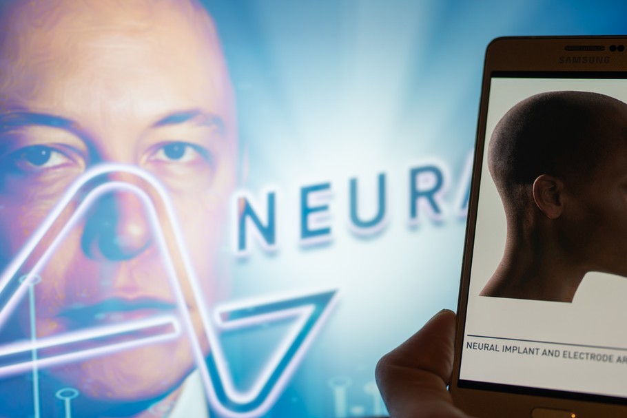 Neuralink